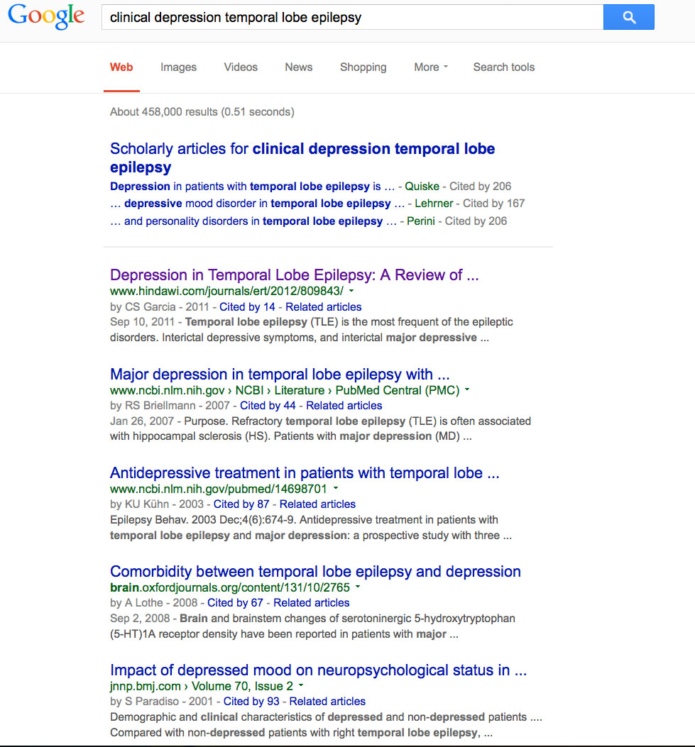 Clinical Depression Temporal Lobe Epilpesy